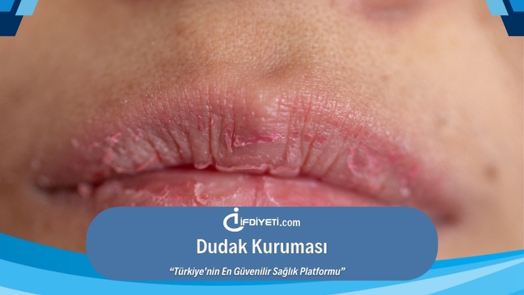 dudak-kurumas-nedenleri-ve-etkili-tedavi-y-ntemleri-fd-yet-com