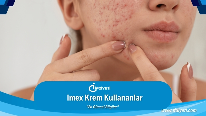 Imex Krem Kullananların Yorumları | İFDİYETİ.COM