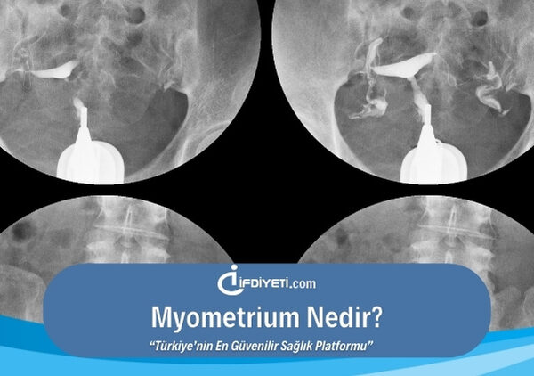Myometrium Nedir?